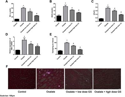 Metabolic and Network Pharmacological Analyses of the Therapeutic Effect of Grona styracifolia on Calcium Oxalate-Induced Renal Injury